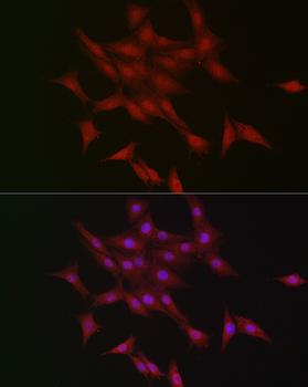 STK11 antibody