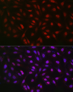 STK11 antibody