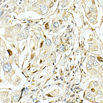 STK11 antibody