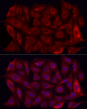 MMP7 antibody