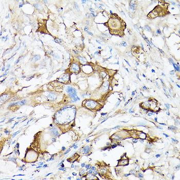 MMP7 antibody