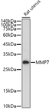 MMP7 antibody