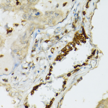 TLR1 antibody