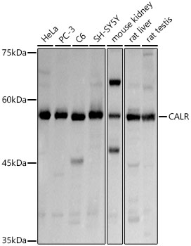 CALR antibody