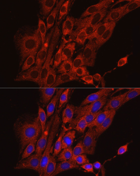 CALR antibody