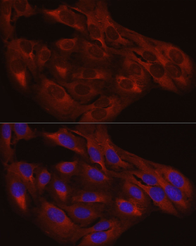 CALR antibody