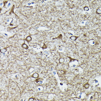 CALR antibody