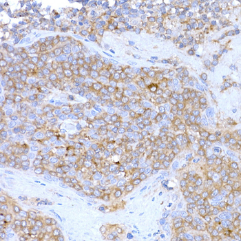 MAGED1 antibody