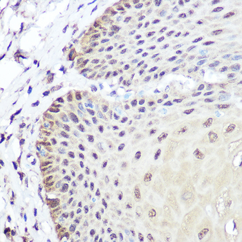 SOX2 antibody