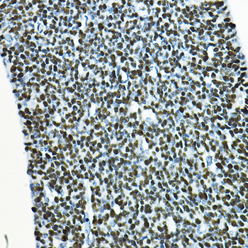 SOX2 antibody