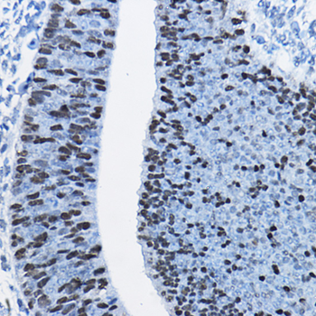 SOX2 antibody