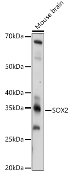 SOX2 antibody