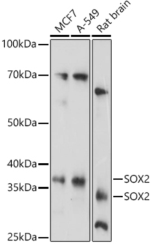 SOX2 antibody