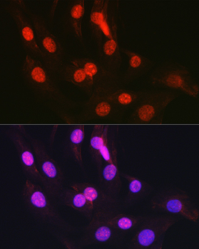 CTCF antibody