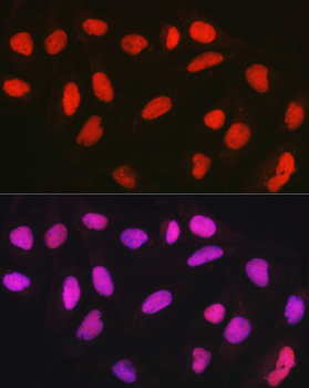 CTCF antibody