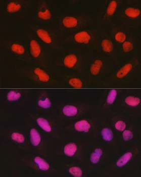 CTCF antibody