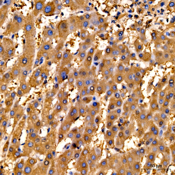 FTH1 antibody