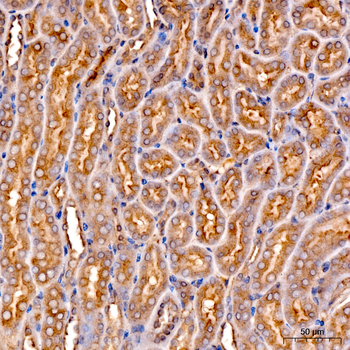 FTH1 antibody