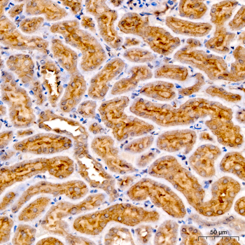 FTH1 antibody