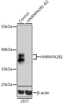 HNRNPA2B1 antibody