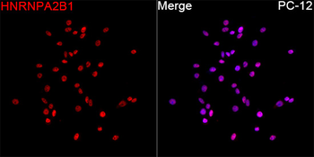 HNRNPA2B1 antibody