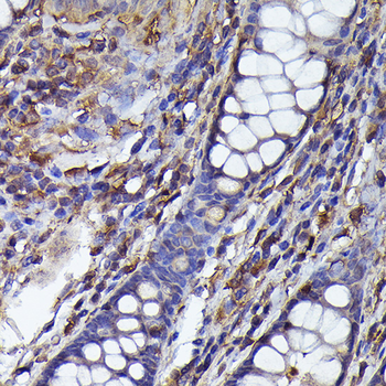 ARRB2 antibody