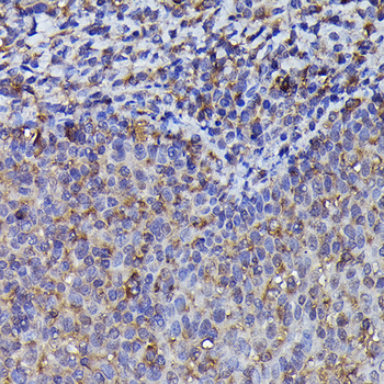 ARRB2 antibody