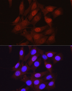 ARRB2 antibody