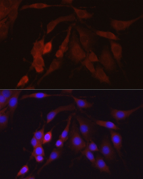 ARRB2 antibody