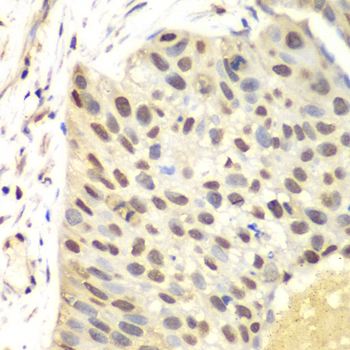 FEN1 antibody