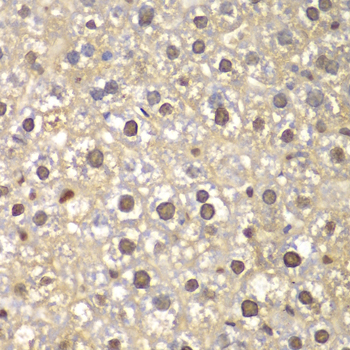 FEN1 antibody