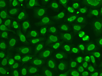 FEN1 antibody