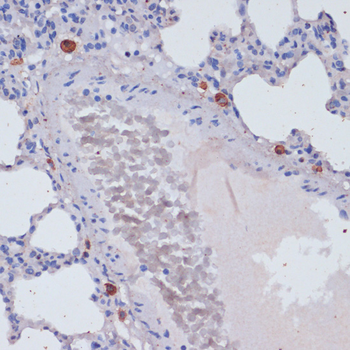 PRF1 antibody