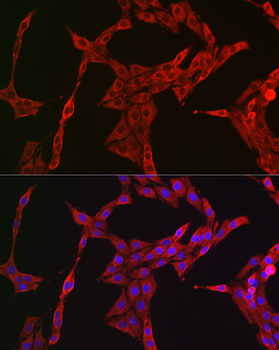 STAT3 antibody