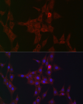 STAT3 antibody