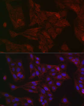 STAT3 antibody