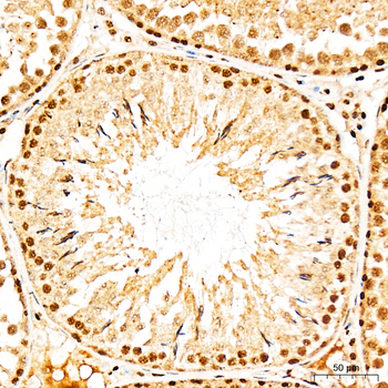 PRKAA1 antibody