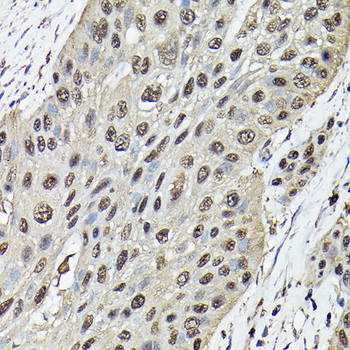 ATXN3 antibody