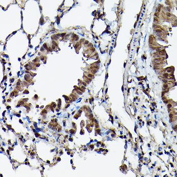 ATXN3 antibody