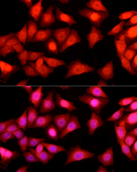 ATXN3 antibody