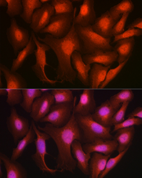 ATXN3 antibody