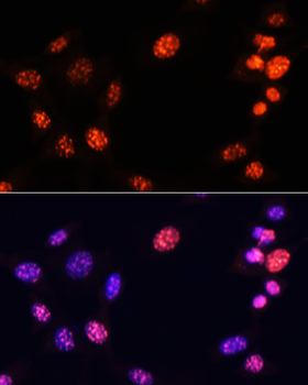 TriMethyl-Histone H3-K64 antibody