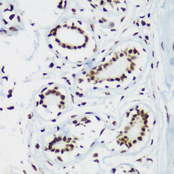 TriMethyl-Histone H3-K64 antibody