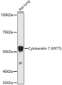 KRT7 antibody