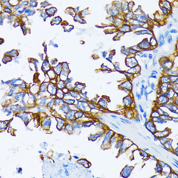 KRT7 antibody