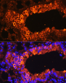 KRT7 antibody