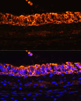 KRT7 antibody