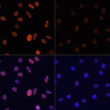 Acetyl-Histone H2B-K12 antibody