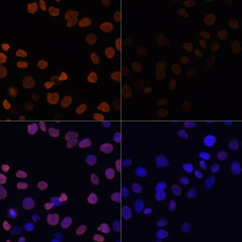 Acetyl-Histone H2B-K12 antibody