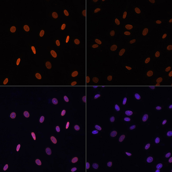 Acetyl-Histone H2B-K12 antibody